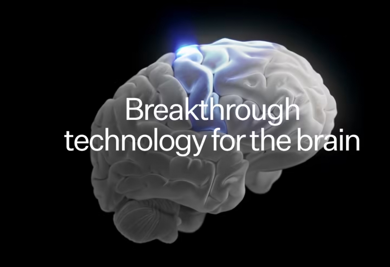 马斯克被曝将旗下脑机接口公司 Neuralink 登记为“小微企业”以优先获得政府合同(图1)